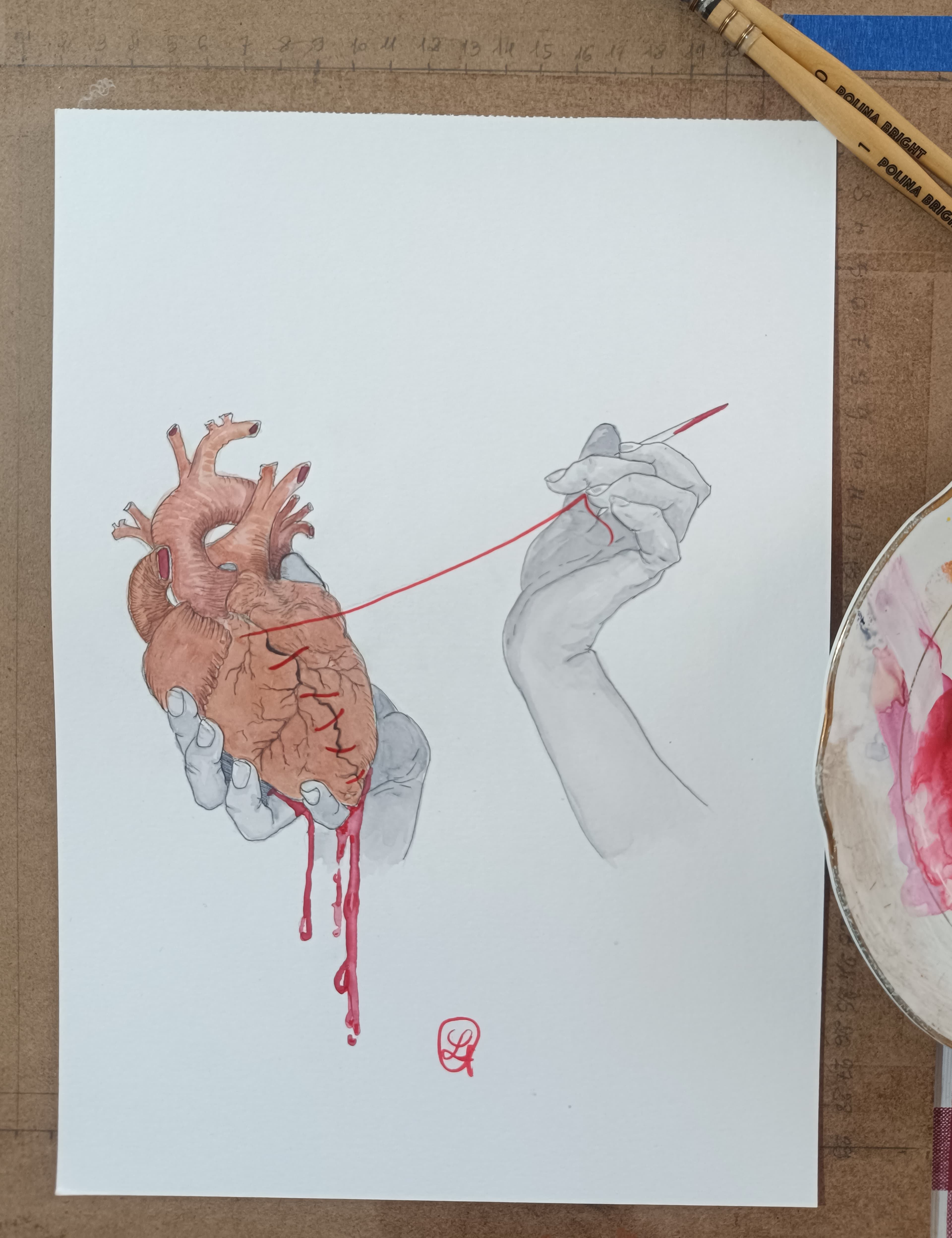 Self-suture